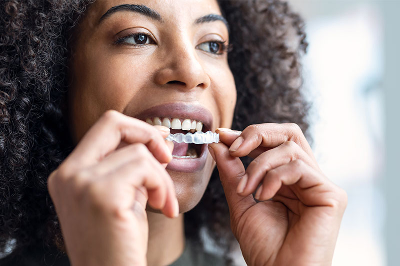 Clear Aligner Therapy in Orlando