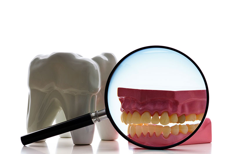 Root Canal Treatment in Orlando