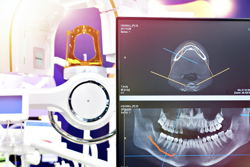 Digital X-Rays in Orlando