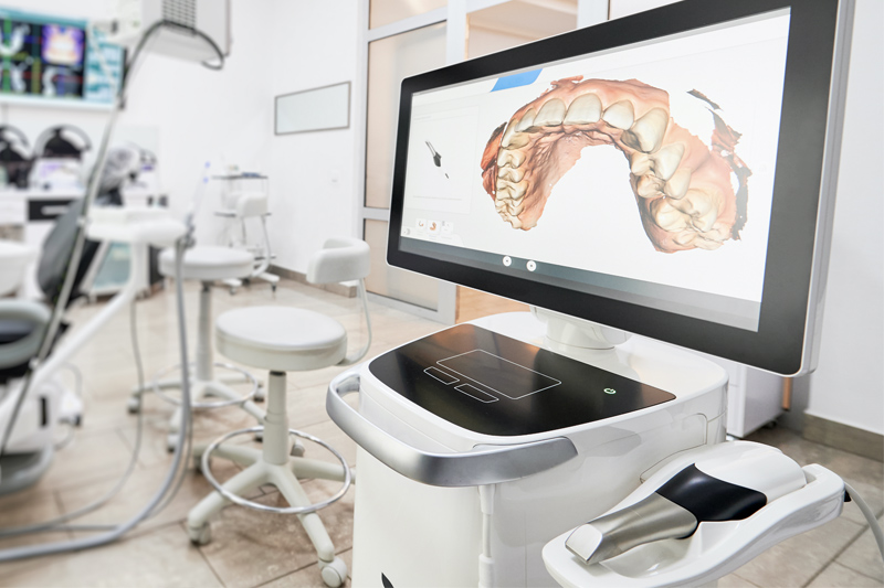 Intra-Oral Scanner in Orlando